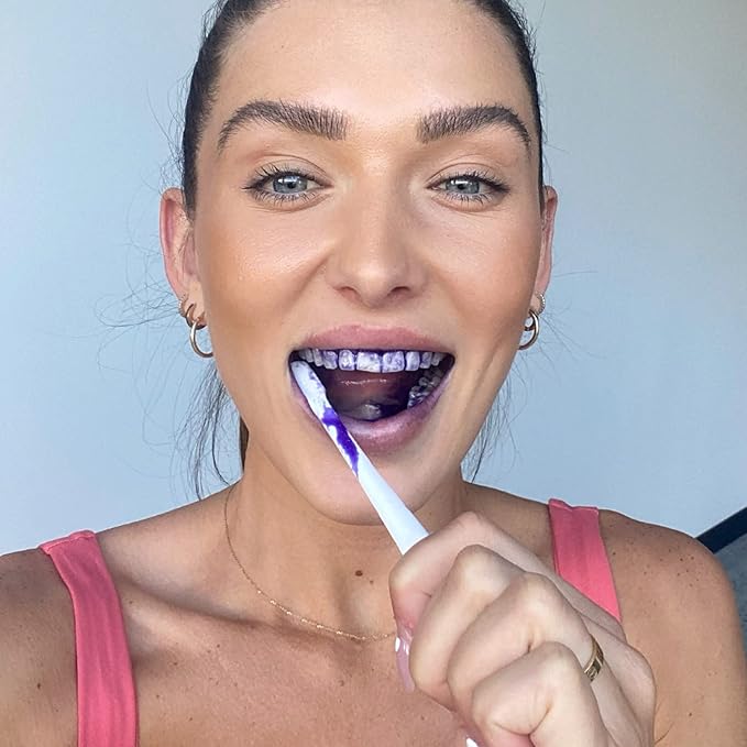 Hismile V34 Corrector Dental Violeta