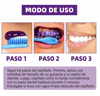 Hismile V34 Corrector Dental Violeta